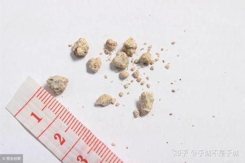 肾结石吃梨瓜行吗,天然食疗新选择